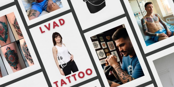 LVAD and Tattoos—What You Need to Know